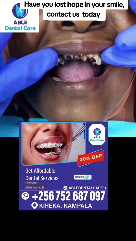 TikTok video thumbnail by abledentalcare235