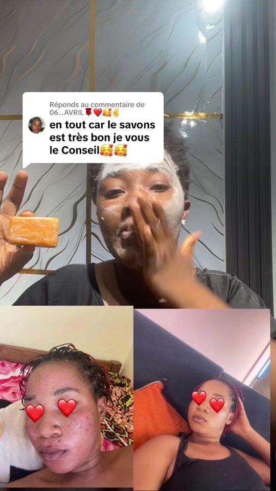TikTok video thumbnail by rootglowskincare