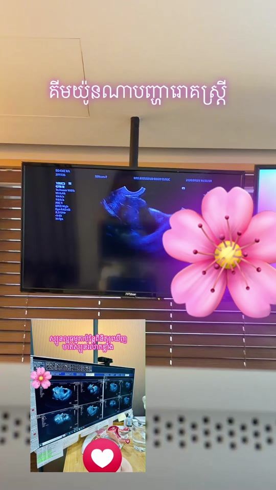 TikTok video thumbnail by juna9966