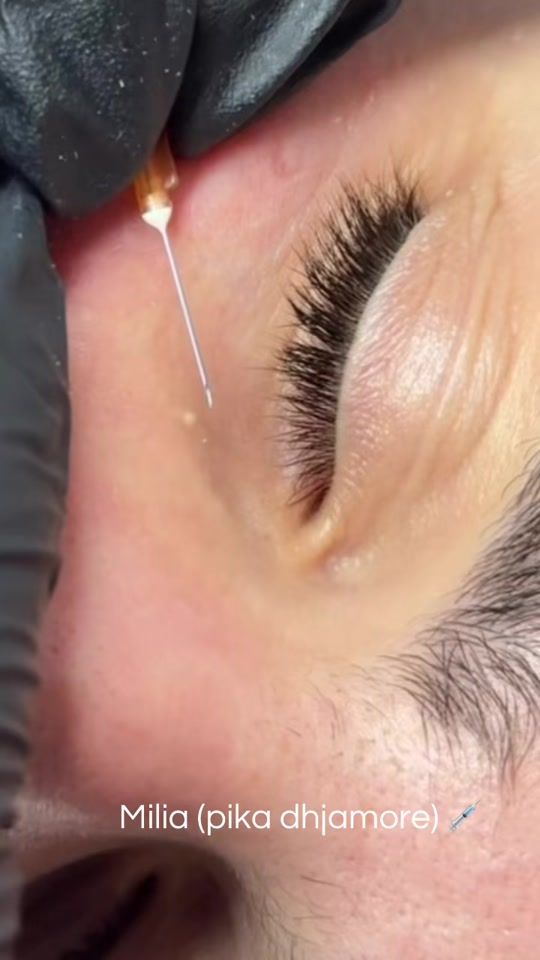 TikTok video thumbnail by skin_therapyy