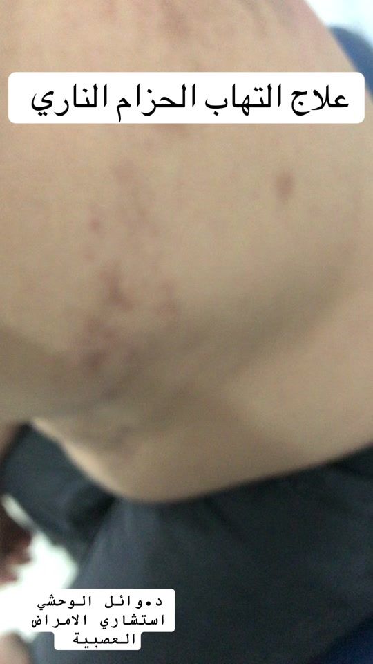 TikTok video thumbnail by drwael4