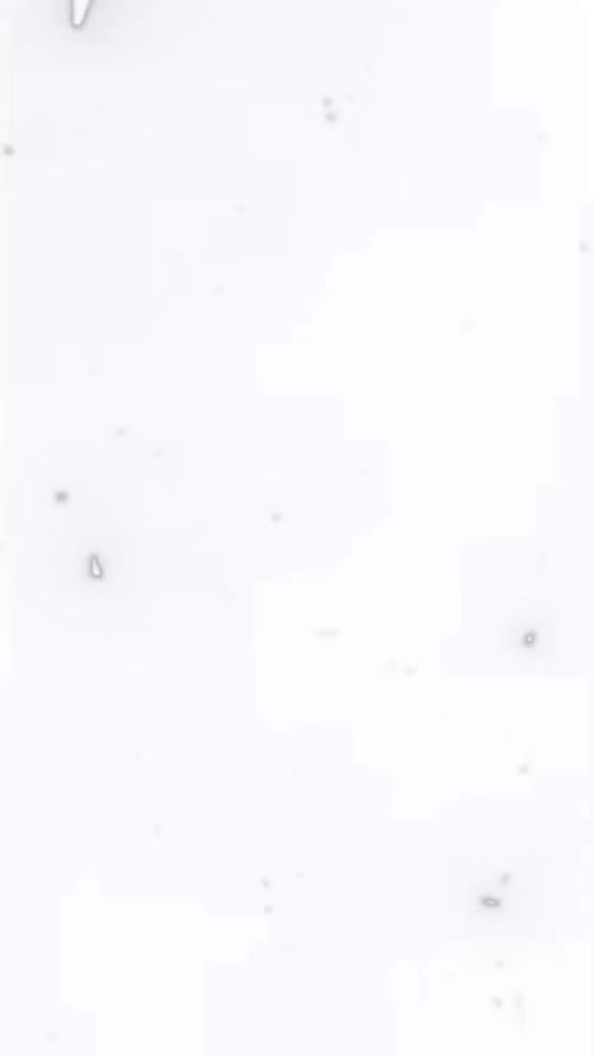 TikTok video thumbnail by glaa.yknknrd_