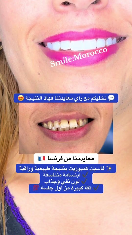 TikTok video thumbnail by smile.morocco4