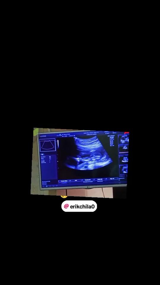 TikTok video thumbnail by 2006_rhlm