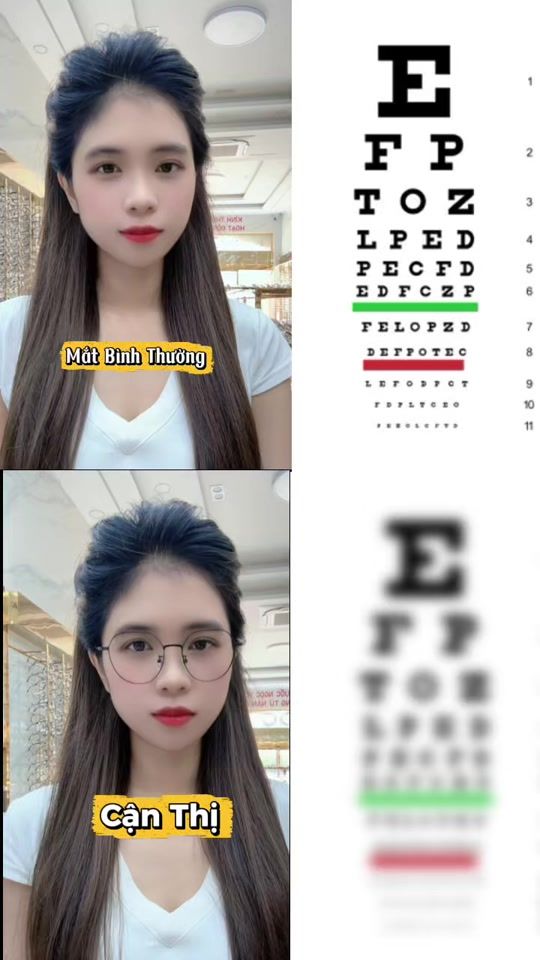 TikTok video thumbnail by huong.eyecare