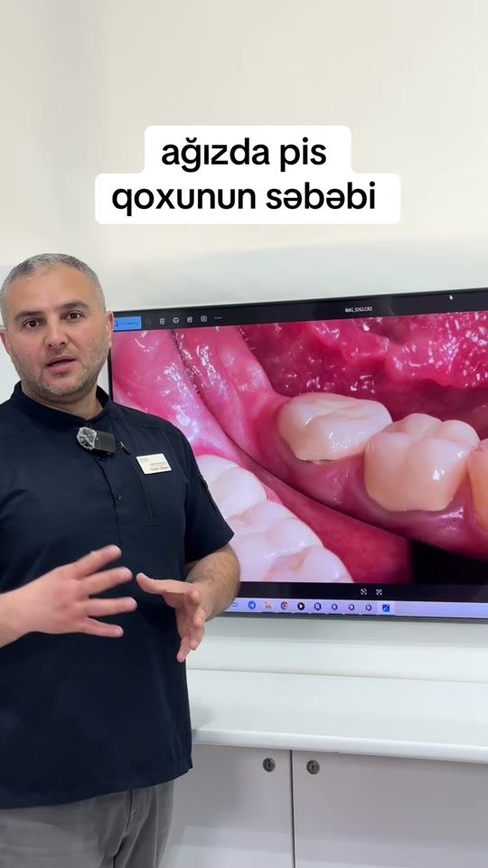 TikTok video thumbnail by dentist.orxan