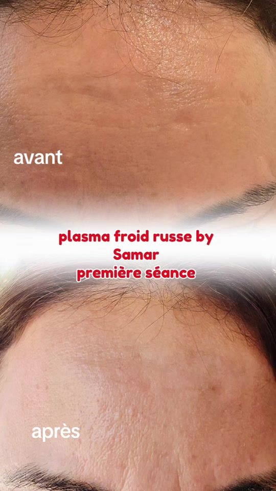 TikTok video thumbnail by samourret