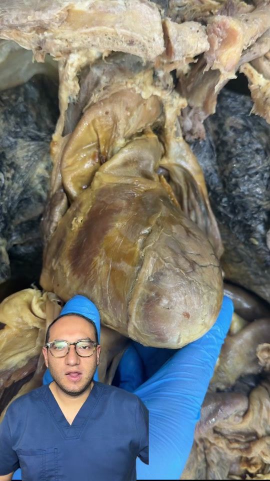 TikTok video thumbnail by dr.giogalindo