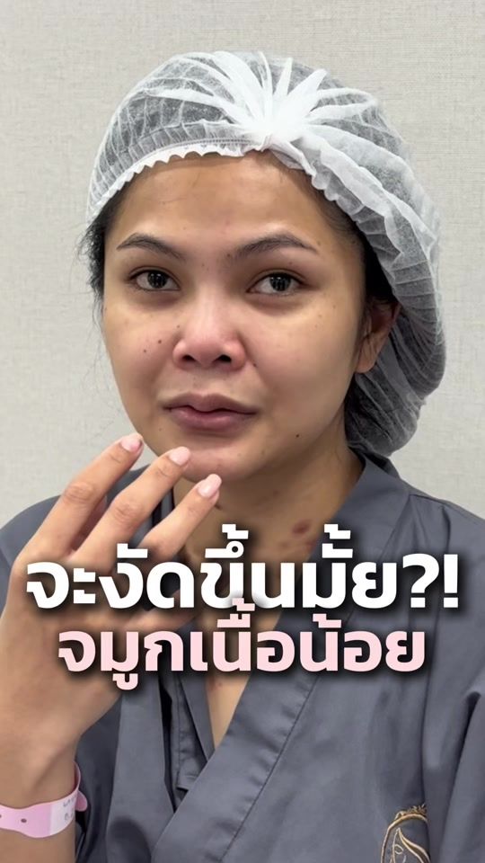 TikTok video thumbnail by lelux_surgery