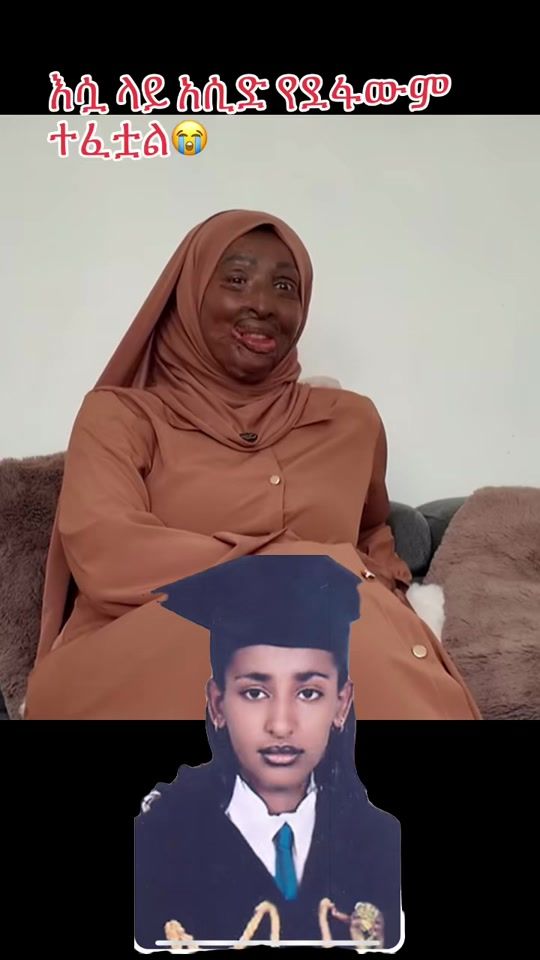 TikTok video thumbnail by eidtube