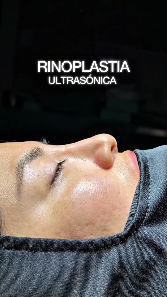 TikTok video thumbnail by dr_rafael_carrera