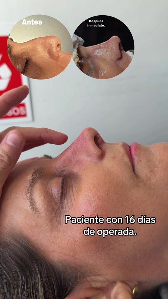 TikTok video thumbnail by dr.luisvargas