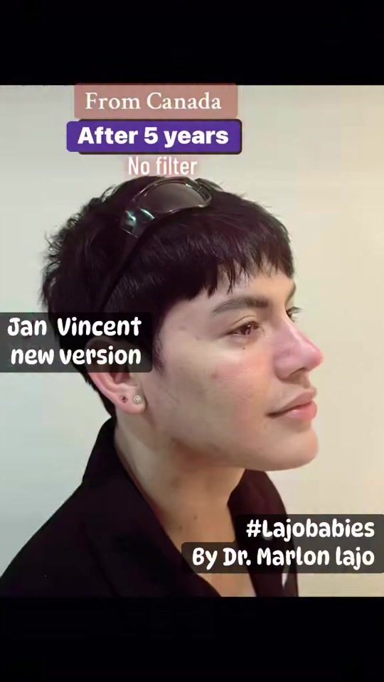 TikTok video thumbnail by lajo_md