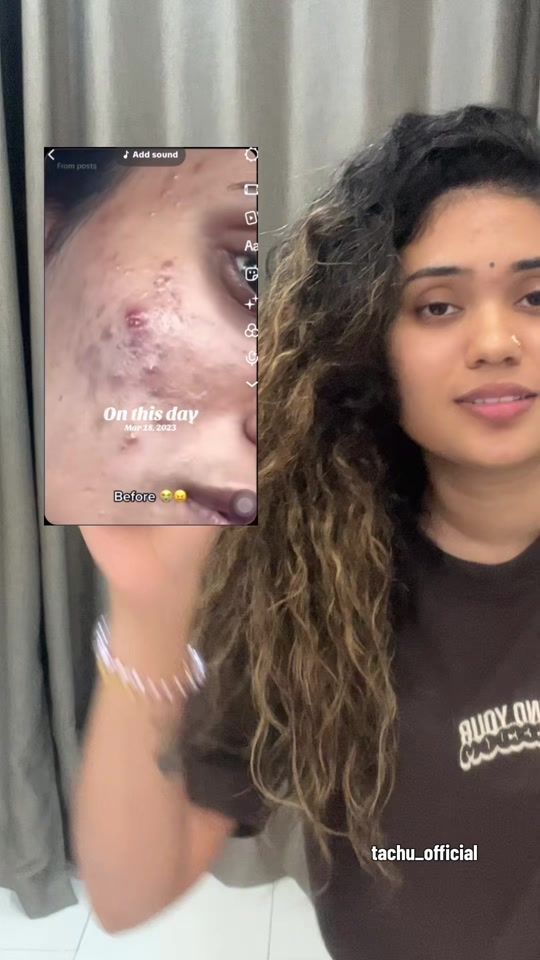 TikTok video thumbnail by tarchini_29