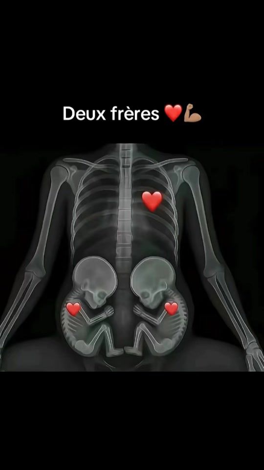 TikTok video thumbnail by deux_freres2