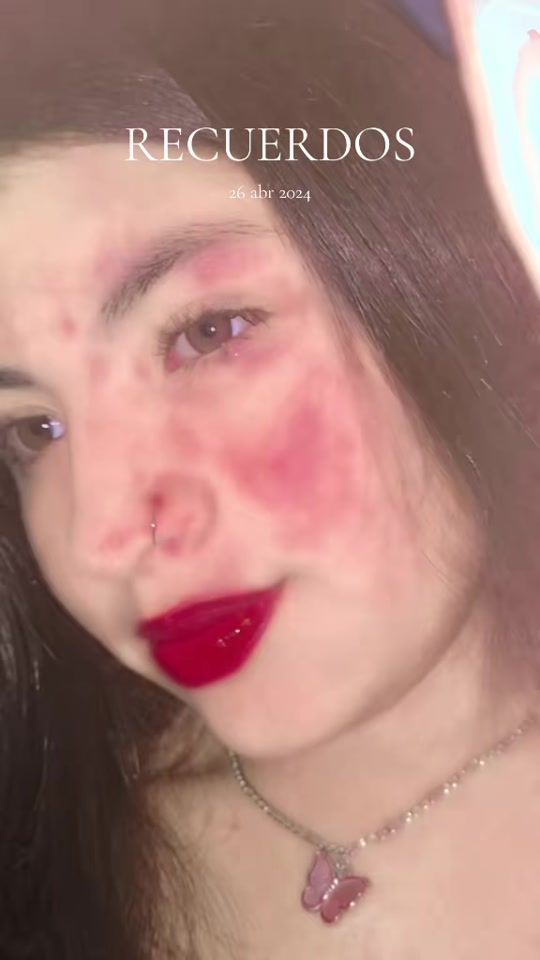 TikTok video thumbnail by aligs216