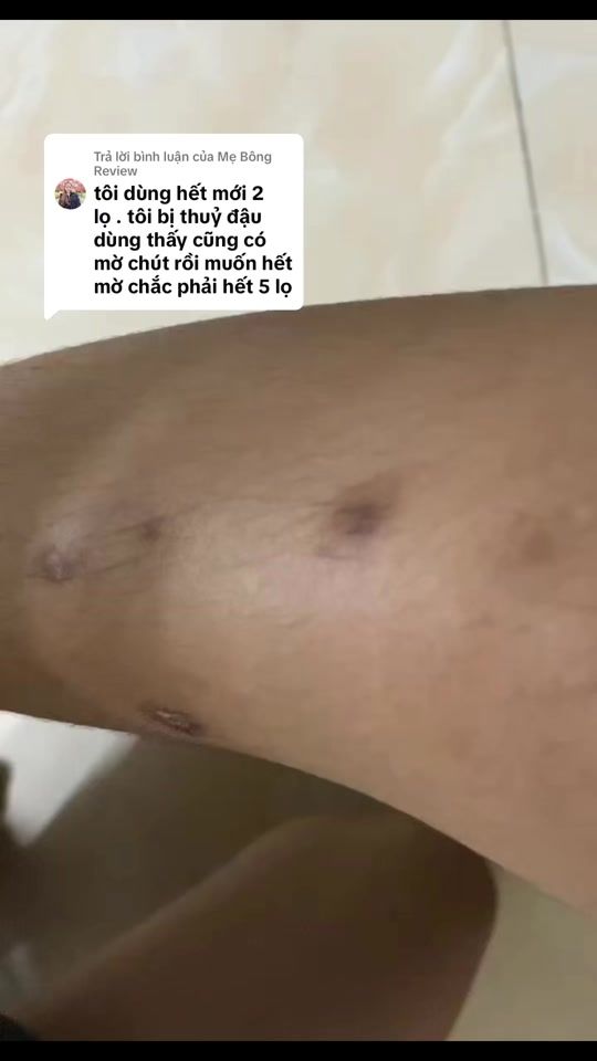 TikTok video thumbnail by hh_skin