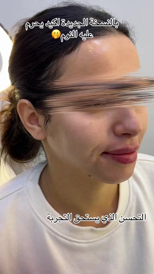 TikTok video thumbnail by nassimaextrabeaute