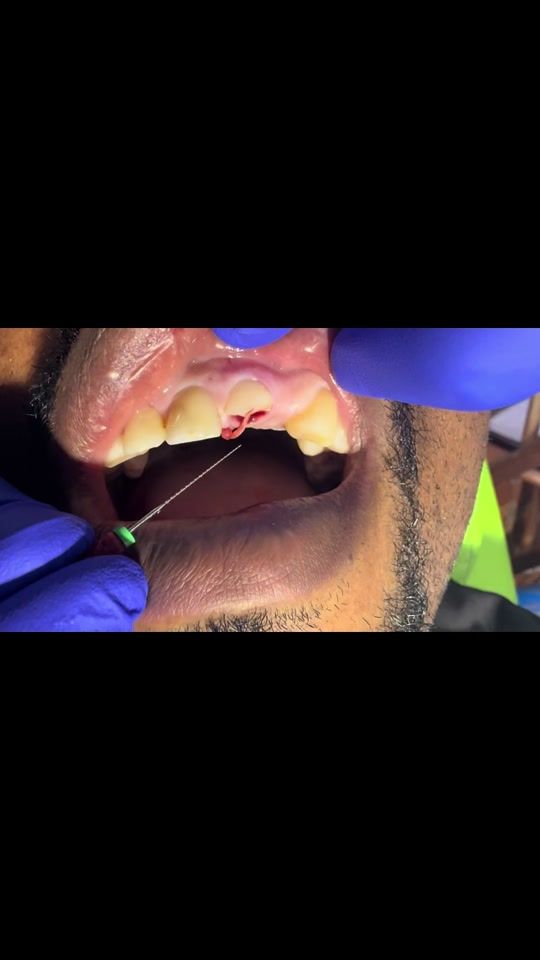 TikTok video thumbnail by 15npolyclinic