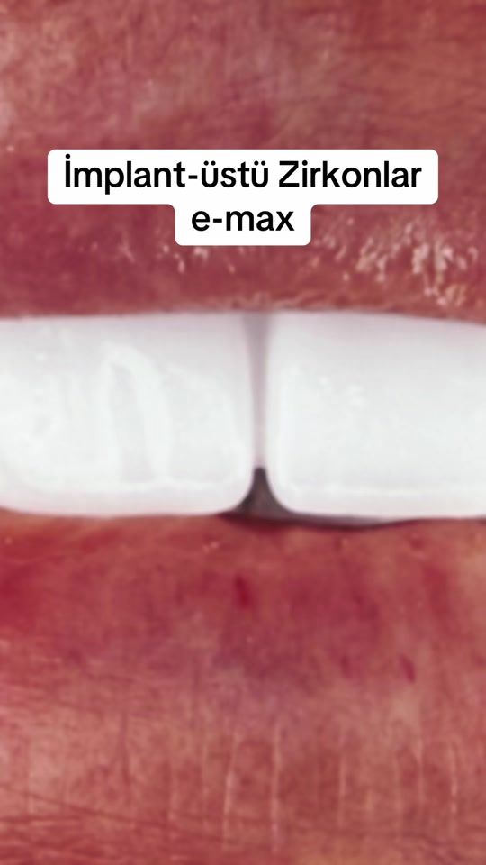 TikTok video thumbnail by dentistrza