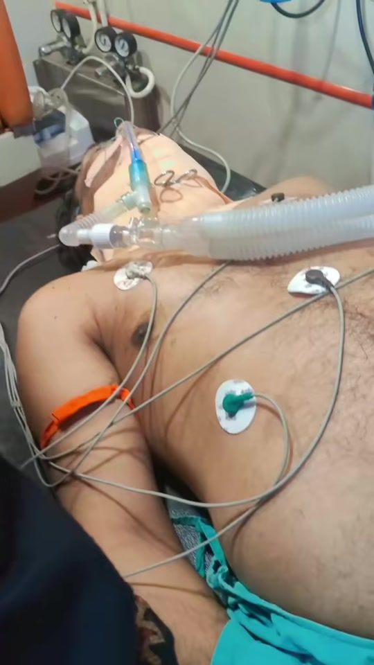 TikTok video thumbnail by dr_sanjay_0