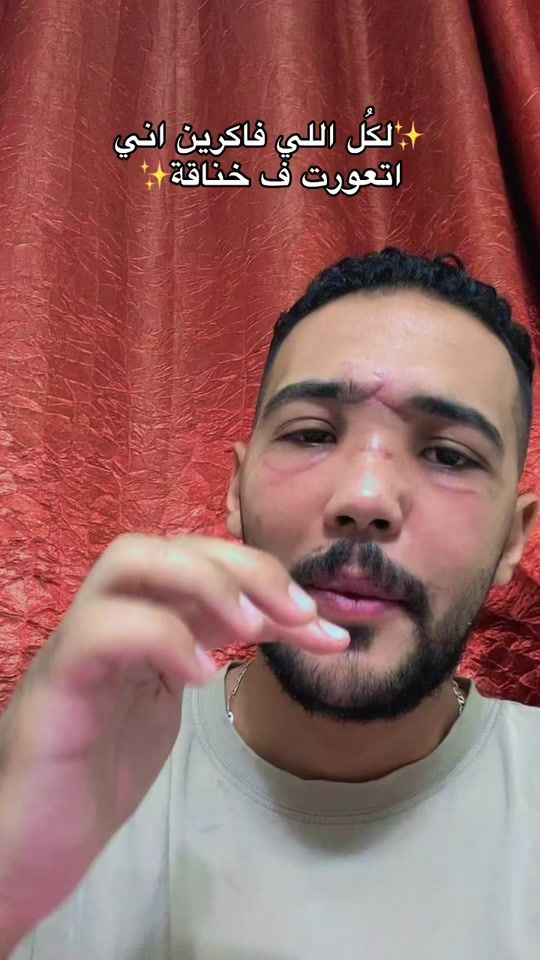 TikTok video thumbnail by mahmoudtarek32
