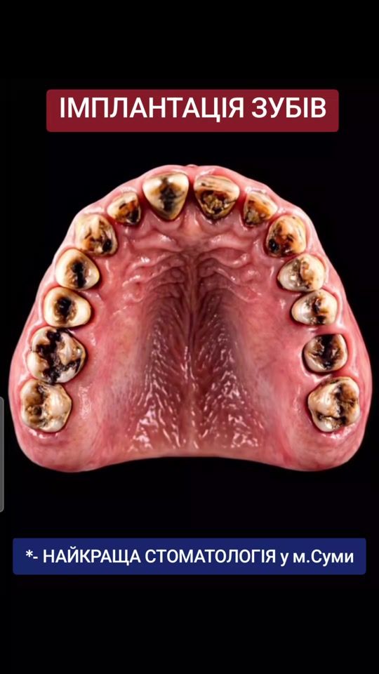 TikTok video thumbnail by dr.mova