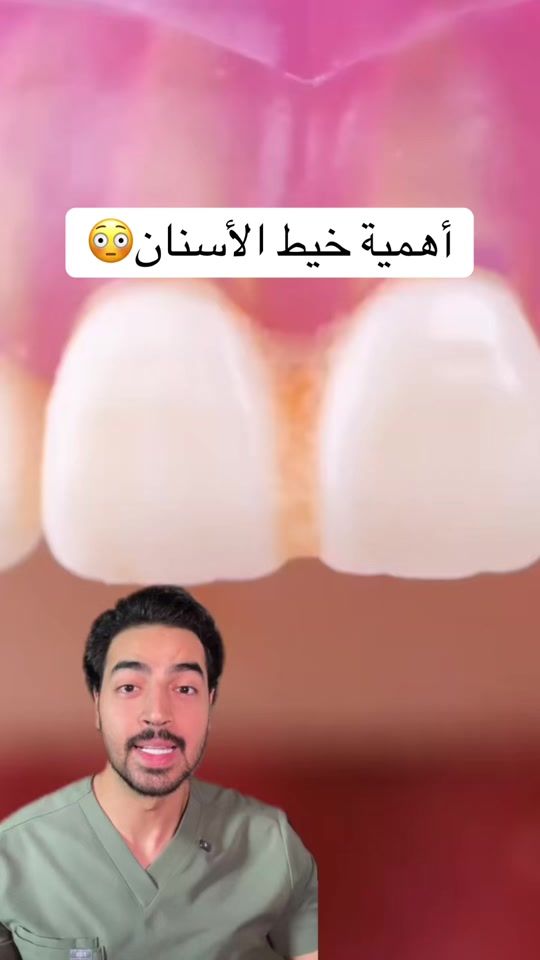 TikTok video thumbnail by dr.mohammad_khaalil