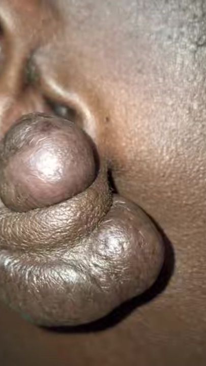 TikTok video thumbnail by dr..mayada.dermab