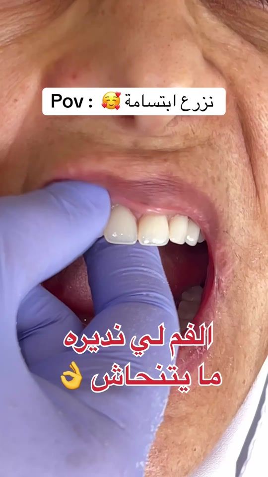 TikTok video thumbnail by dr.elbouali.02chlef