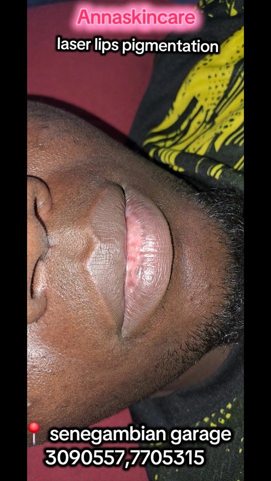 TikTok video thumbnail by annaoganicskincare