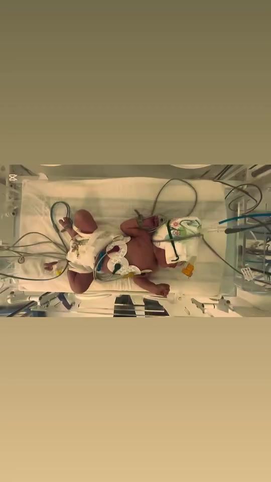TikTok video thumbnail by paramedic_iq