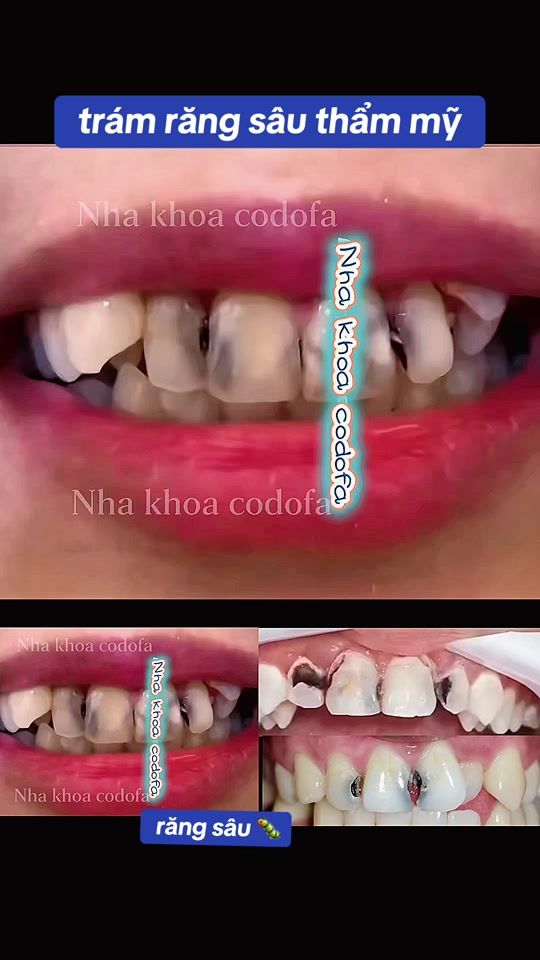 TikTok video thumbnail by nhakhoa_codofa
