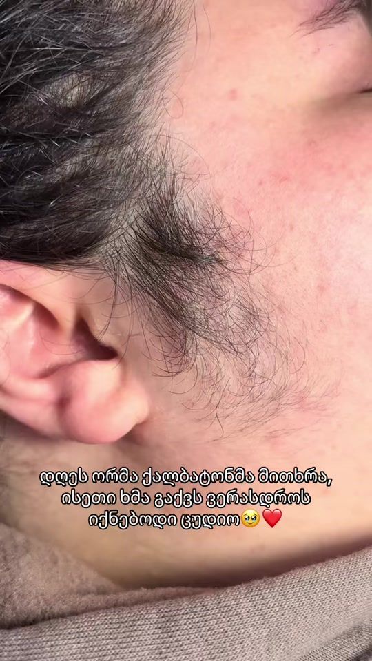 TikTok video thumbnail by electricepilation