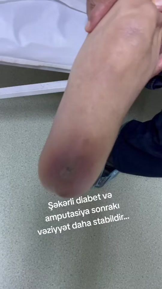 TikTok video thumbnail by doktor6878
