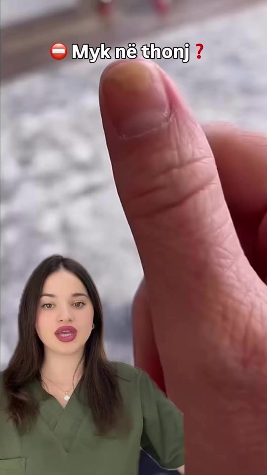 TikTok video thumbnail by skin_therapyy