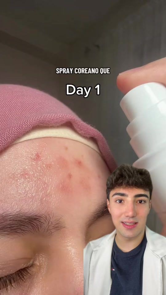 TikTok video thumbnail by vitinhonic