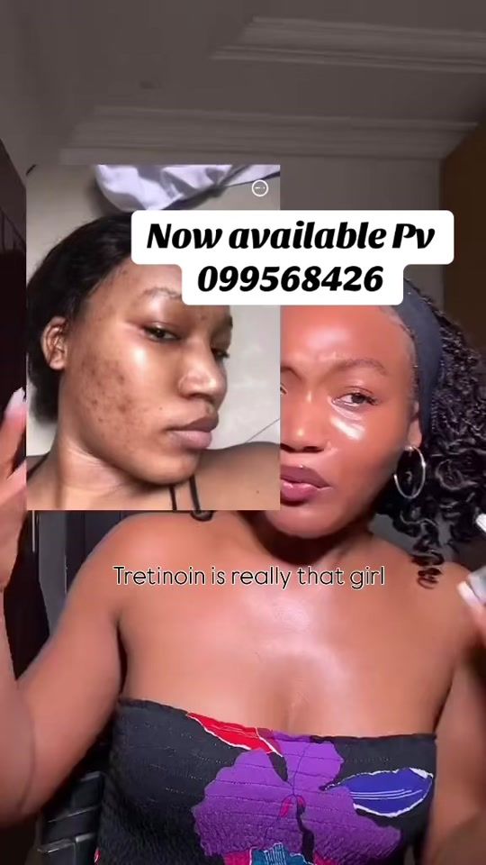 TikTok video thumbnail by mustaphakamara792