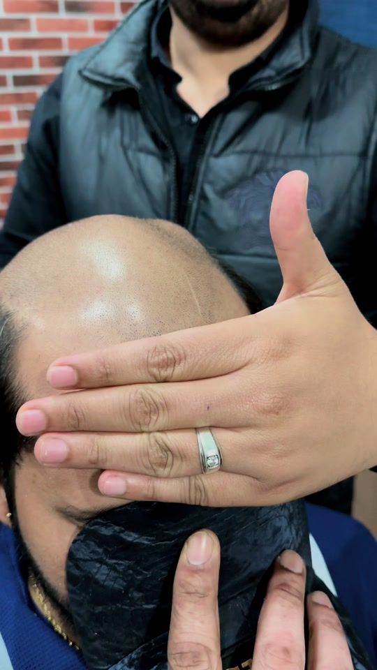 TikTok video thumbnail by hairsolutionclub9