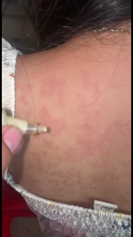 TikTok video thumbnail by skincarehour2