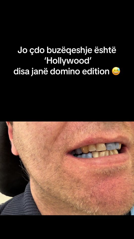 TikTok video thumbnail by keoldent