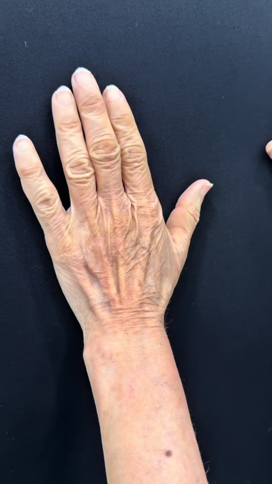 TikTok video thumbnail by dr.hersh83