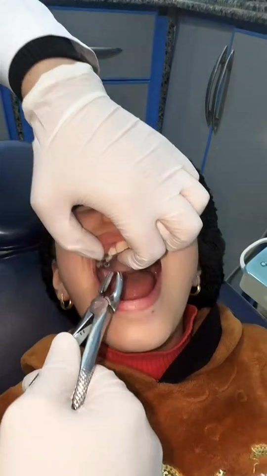 TikTok video thumbnail by dr.wajidshah.jan1