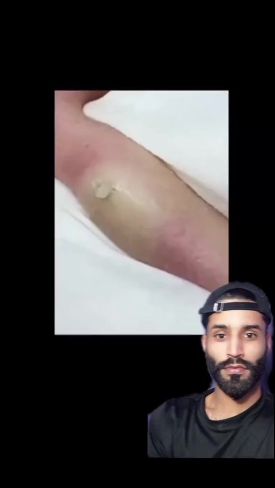 TikTok video thumbnail by psiquicamentee
