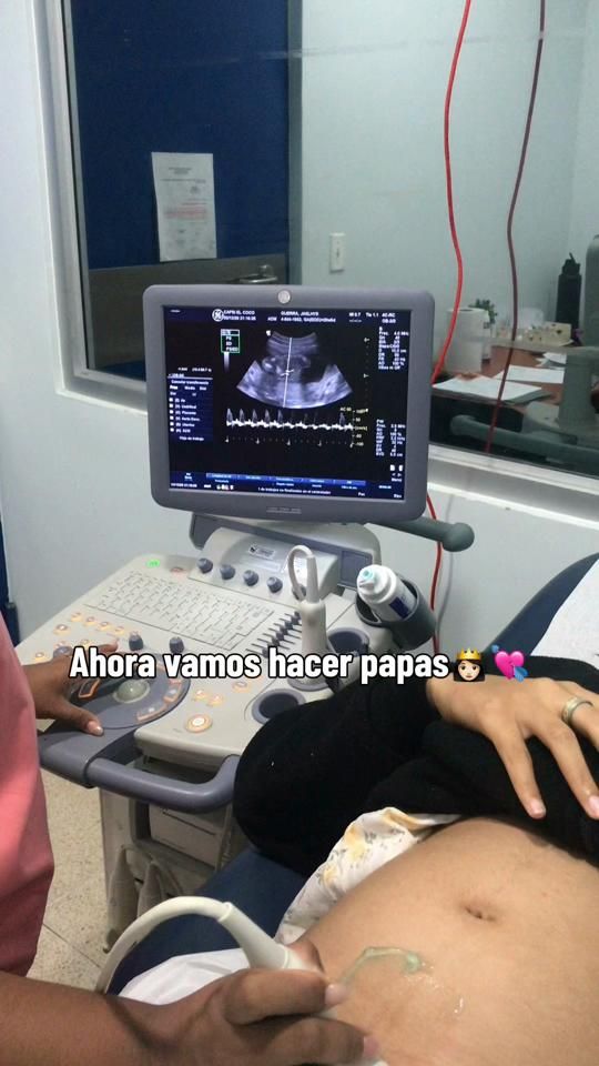 TikTok video thumbnail by anggeeel_03