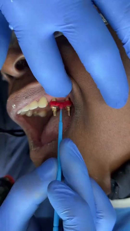 TikTok video thumbnail by arcdentistry