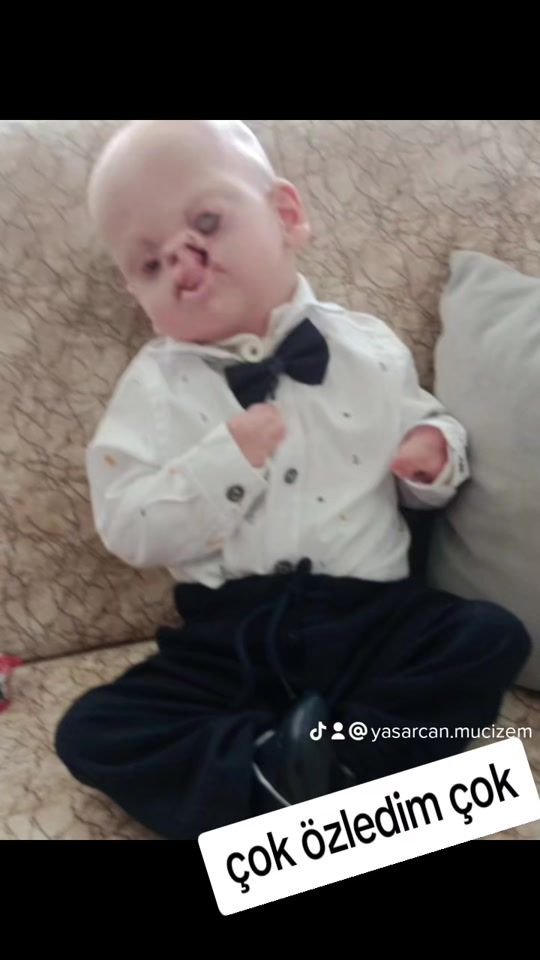 TikTok video thumbnail by sevilyasarcan.yedek