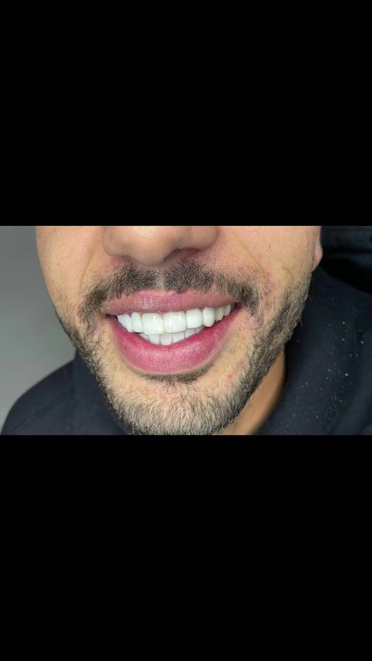 TikTok video thumbnail by hasnaa.smile