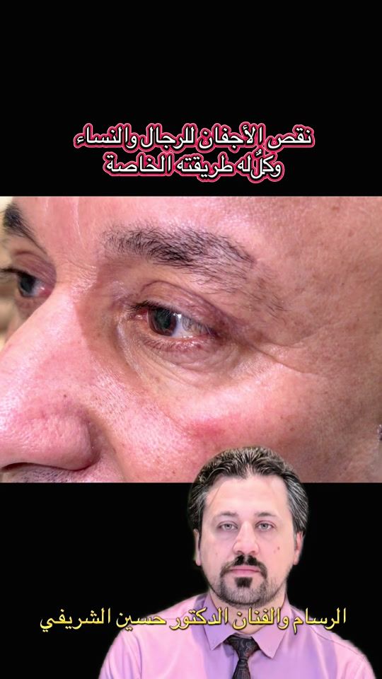 TikTok video thumbnail by dr.h_sh