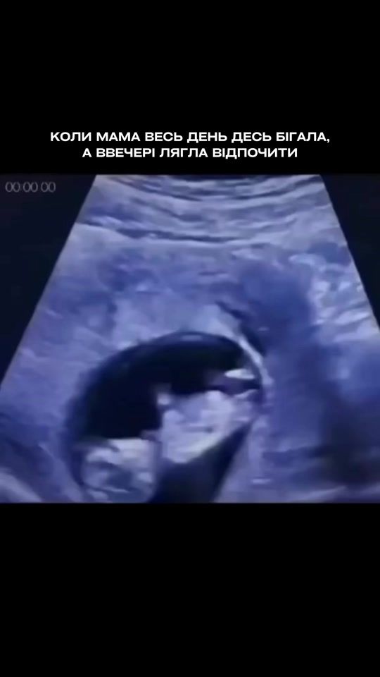 TikTok video thumbnail by icsi_clinic